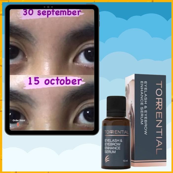 Torrential Eyelash and Eyebrow Growth Serum 